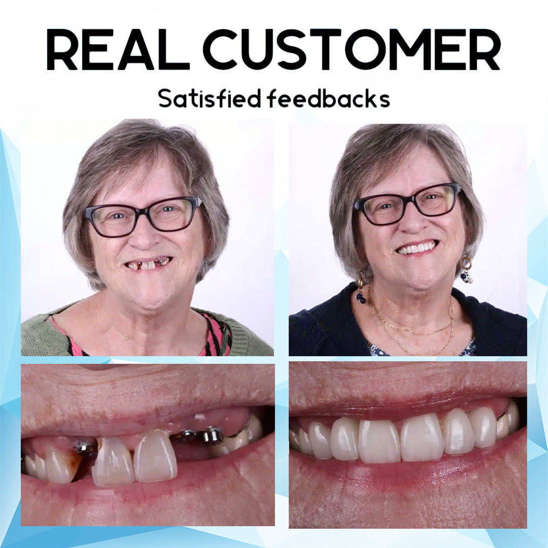 šFurzero⢠Silicone Reline Denture Setš¦·āØš„ Limited Time Discount: 75% OFF