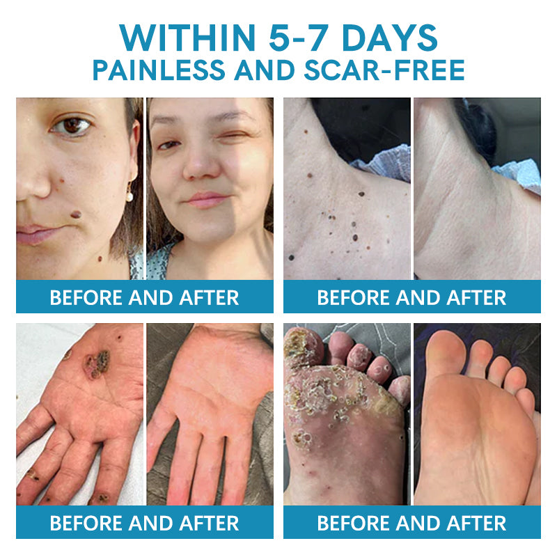 Ourlyard™ Multi-Symptom Bee Venom Treatment Cream