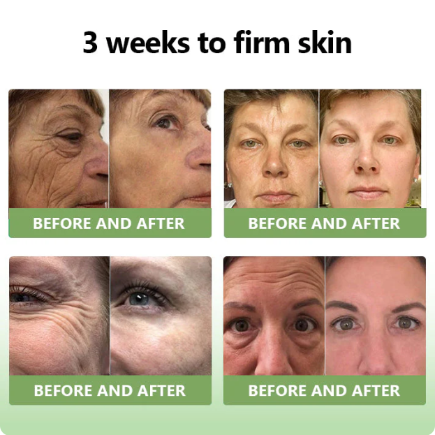 ✅FDA Approval💝Furzero™ Luxurious Collagen Peptide Firming Cream🔥Maximum 75 OFF!🔥