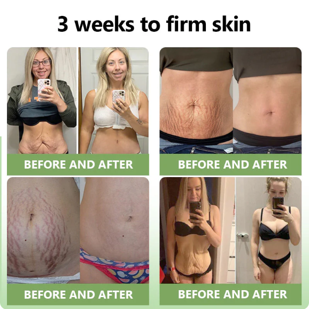 ✅FDA Approval💝Furzero™ Luxurious Collagen Peptide Firming Cream🔥Maximum 75 OFF!🔥