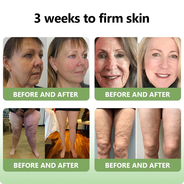 ✅FDA Approval💝Furzero™ Luxurious Collagen Peptide Firming Cream🔥Maximum 75 OFF!🔥