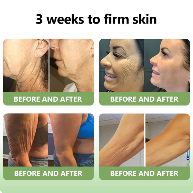 ✅FDA Approval💝Furzero™ Luxurious Collagen Peptide Firming Cream🔥Maximum 75 OFF!🔥