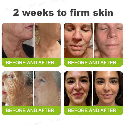 🏅👨‍⚕️Made and shipped from the USA 💫Rolimey® Botox & Vita-A Retinol Shot Wrinkle-Lift Tightening cream - Last Day Promotion 70% OFF