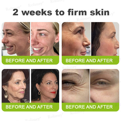 🏅👨‍⚕️Made and shipped from the USA 💫Rolimey® Botox & Vita-A Retinol Shot Wrinkle-Lift Tightening cream - Last Day Promotion 70% OFF