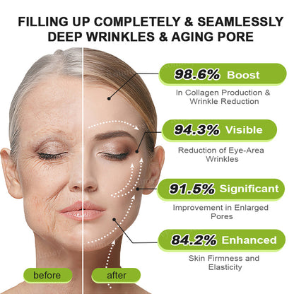 🏅👨‍⚕️Made and shipped from the USA 💫Rolimey® Botox & Vita-A Retinol Shot Wrinkle-Lift Tightening cream - Last Day Promotion 70% OFF