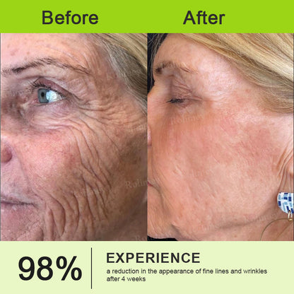 👨‍⚕️Made and Shipped from the USA ✅Rolimey® Botox & Vita-A Retinol Shot Wrinkle-Lift Tightening stick- Last Day Promotion 70% OFF🔥LAST DAY 70% OFF