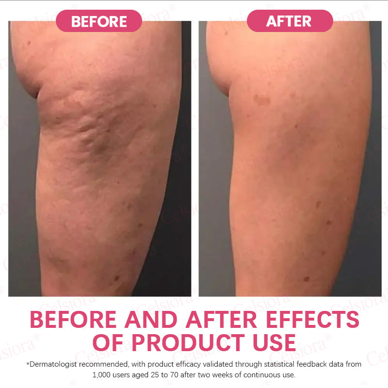 👩‍⚕️💙Made and shipped from USA 💫Celsiora® PDRN + Collagen Wrinkle-Lift Tightening Serum Stick - Last Day Promotion 70% OFF