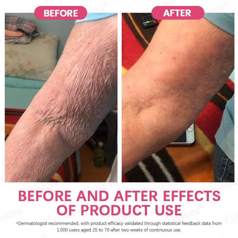 👩‍⚕️💙Made and shipped from USA 💫Celsiora® PDRN + Collagen Wrinkle-Lift Tightening Serum Stick - Last Day Promotion 70% OFF