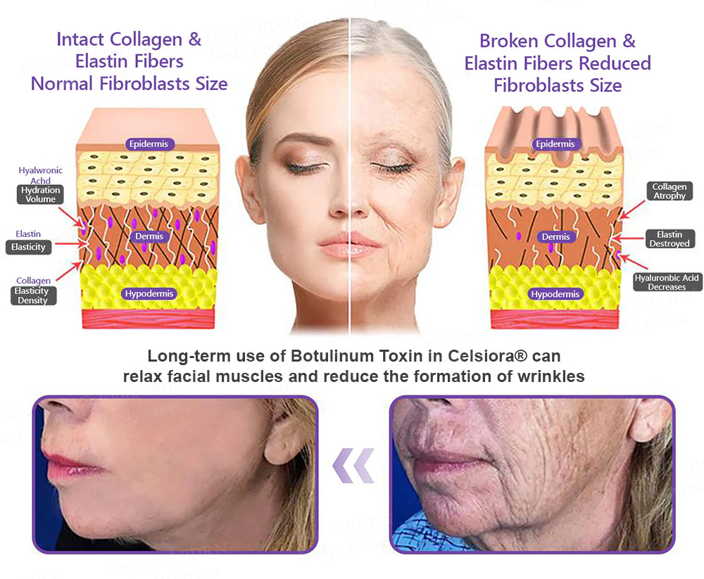 ❤FDA Official: Celsiora® PDRN Multi-Peptide Massaging Body Roller Cream- Anti-aging, Hydrating, Skin Firming & Lifting, Skin Repair, Even Tone, Acne and Dark Spot Treatment, Wart and Mole Removal, and Psoriasis Relief.