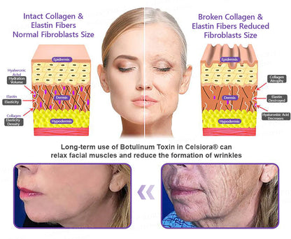 ❤FDA Official: Celsiora® PDRN Multi-Peptide Massaging Body Roller Cream- Anti-aging, Hydrating, Skin Firming & Lifting, Skin Repair, Even Tone, Acne and Dark Spot Treatment, Wart and Mole Removal, and Psoriasis Relief.