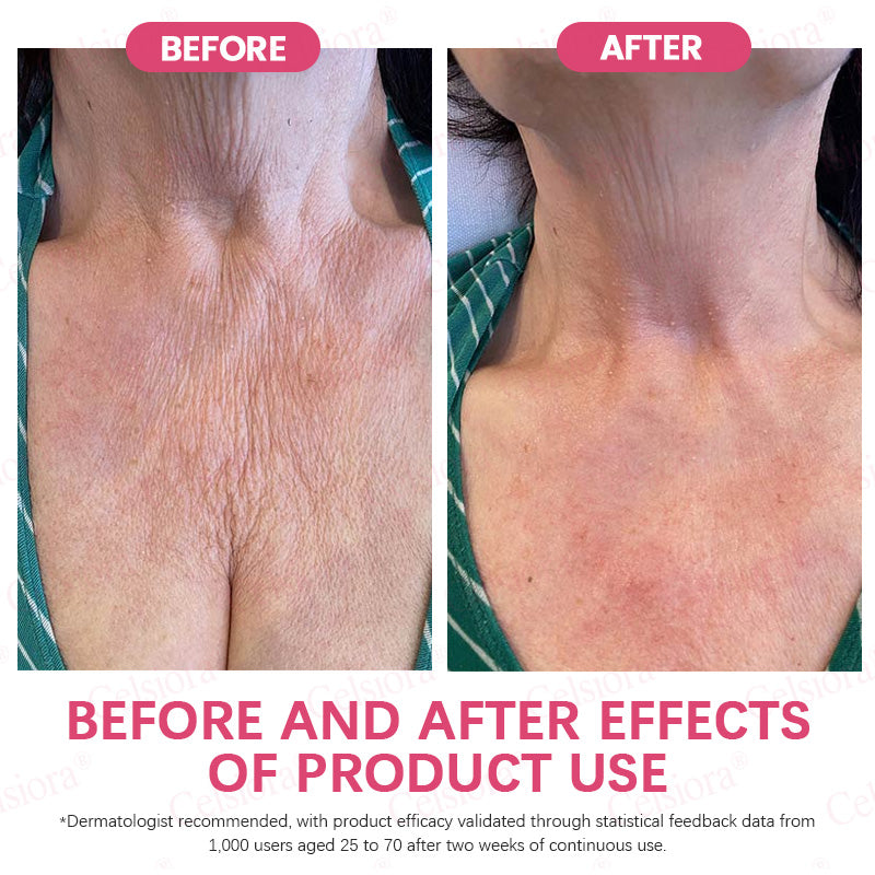 👩‍⚕️💙Made and shipped from USA 💫Celsiora® PDRN + Collagen Wrinkle-Lift Tightening Serum Stick - Last Day Promotion 70% OFF