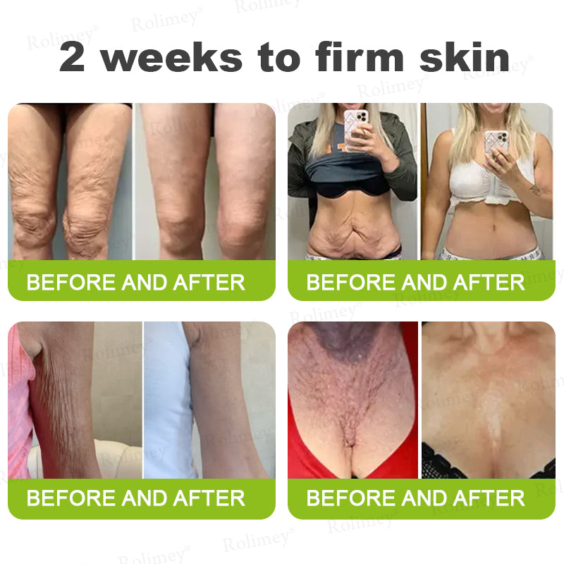 🏅👨‍⚕️Made and shipped from the USA 💫Rolimey® Botox & Vita-A Retinol Shot Wrinkle-Lift Tightening cream - Last Day Promotion 70% OFF