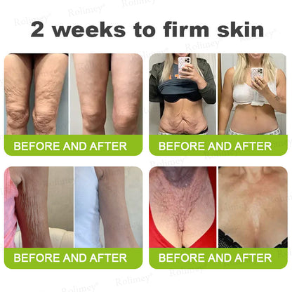 👨‍⚕️Made and Shipped from the USA ✅Rolimey® Botox & Vita-A Retinol Shot Wrinkle-Lift Tightening stick- Last Day Promotion 70% OFF🔥LAST DAY 70% OFF