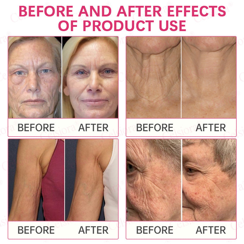 👩‍⚕️💙Made and shipped from USA 💫Celsiora® PDRN + Collagen Wrinkle-Lift Tightening Serum Stick - Last Day Promotion 70% OFF