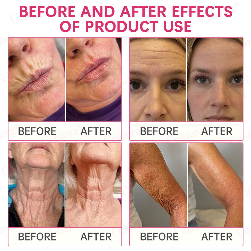 👩‍⚕️💙Made and shipped from USA 💫Celsiora® PDRN + Collagen Wrinkle-Lift Tightening Serum Stick - Last Day Promotion 70% OFF