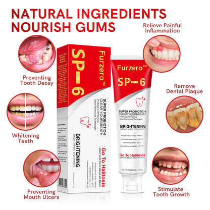 Furzero™ Canadian SP-6 Probiotic Ultra Whitening Toothpaste🦷(✅CDA-CERTIFIED)🔥75% OFF