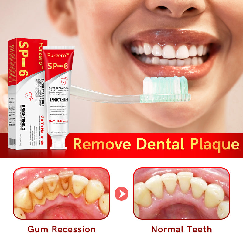Furzero™ Canadian SP-6 Probiotic Ultra Whitening Toothpaste🦷(✅CDA-CERTIFIED)🔥75% OFF