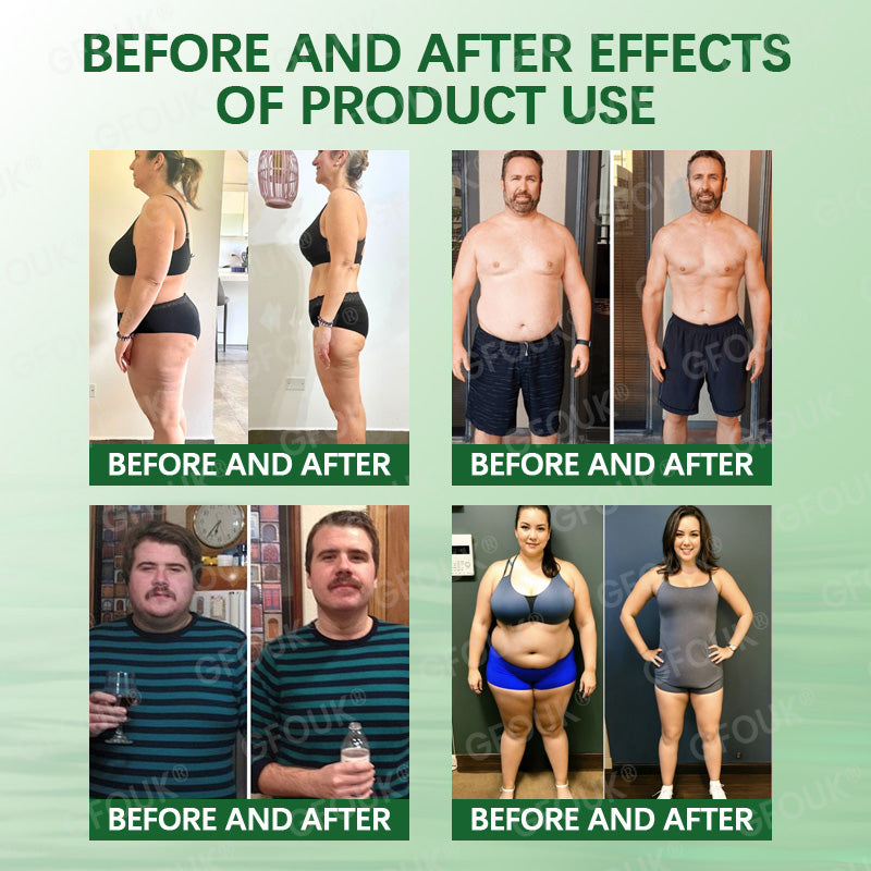 👨‍⚕️🌿𝐎𝐟𝐟𝐢𝐜𝐢𝐚𝐥 𝐒𝐭𝐨𝐫𝐞 🇺🇸 |🗽𝐆𝐅𝐎𝐔𝐊® 𝑴𝒐𝒓𝒊𝒏𝒈𝗮 · 𝗕𝗲𝗿𝗯𝗲𝗿𝙞𝙣𝙚 × 𝙉𝘼𝐃+ 𝟏𝟎-𝐢𝐧-𝟏 𝗔𝗱𝘃𝗮𝗻𝗰𝙚𝙙 𝙉𝙖𝙣𝙤 𝙈𝙞𝙘𝙧𝙤𝙣𝙚𝙚𝐝𝐥𝐞 𝐏𝐚𝐭𝙘𝙝🇺🇸(𝐉𝐮𝐬𝐭 𝐨𝐧𝐜𝐞 𝐚 𝐝𝐚𝐲, 𝐯𝐢𝐬𝐢𝐛𝐥𝐞 𝐜𝐡𝐚𝐧𝐠𝐞𝐬 𝐢𝐧 𝟕 𝐝𝐚𝐲𝐬）✅ 𝐅𝐨𝐫 𝐨𝐛𝐞𝐬𝐢𝐭𝐲, 𝐥𝐨𝐨𝐬𝐞 𝐬𝐤𝐢𝐧,𝐝𝐢𝐚𝐛𝐞𝐭𝐞𝐬, 𝐬𝐥𝐞𝐞𝐩 𝐚𝐩𝐧𝐞𝐚, 𝐣𝐨𝐢𝐧𝐭 𝐢𝐬𝐬𝐮𝐞𝐬, 𝐚𝐧𝐝 𝐦𝐨𝐫𝐞