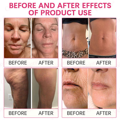 👩‍⚕️💙Made and shipped from USA 💫Celsiora® PDRN + Collagen Wrinkle-Lift Tightening Serum Stick - Last Day Promotion 70% OFF