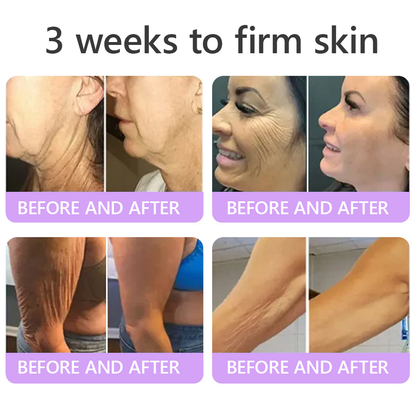 ❤FDA Official: Celsiora® PDRN Multi-Peptide Massaging Body Roller Cream- Anti-aging, Hydrating, Skin Firming & Lifting, Skin Repair, Even Tone, Acne and Dark Spot Treatment, Wart and Mole Removal, and Psoriasis Relief.