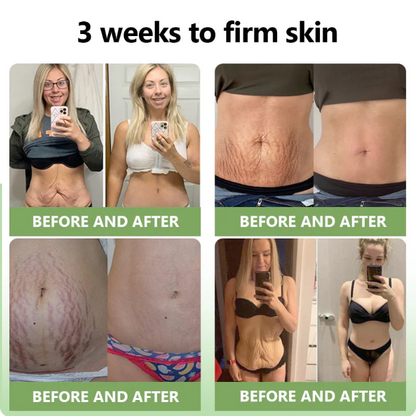 ✅FDA Approval💝Furzero™ Luxurious Collagen Peptide Firming Cream🔥Maximum 75 OFF!🔥
