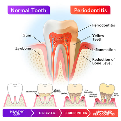 Furzero™ V34 Purple Teeth Whitening Toothpaste
