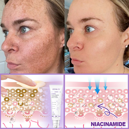 ❤FDA Official: Celsiora® PDRN Multi-Peptide Massaging Body Roller Cream- Anti-aging, Hydrating, Skin Firming & Lifting, Skin Repair, Even Tone, Acne and Dark Spot Treatment, Wart and Mole Removal, and Psoriasis Relief.