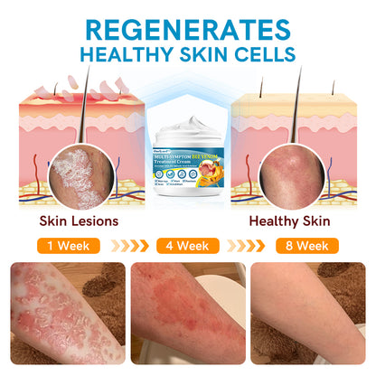 Ourlyard™ Multi-Symptom Bee Venom Treatment Cream