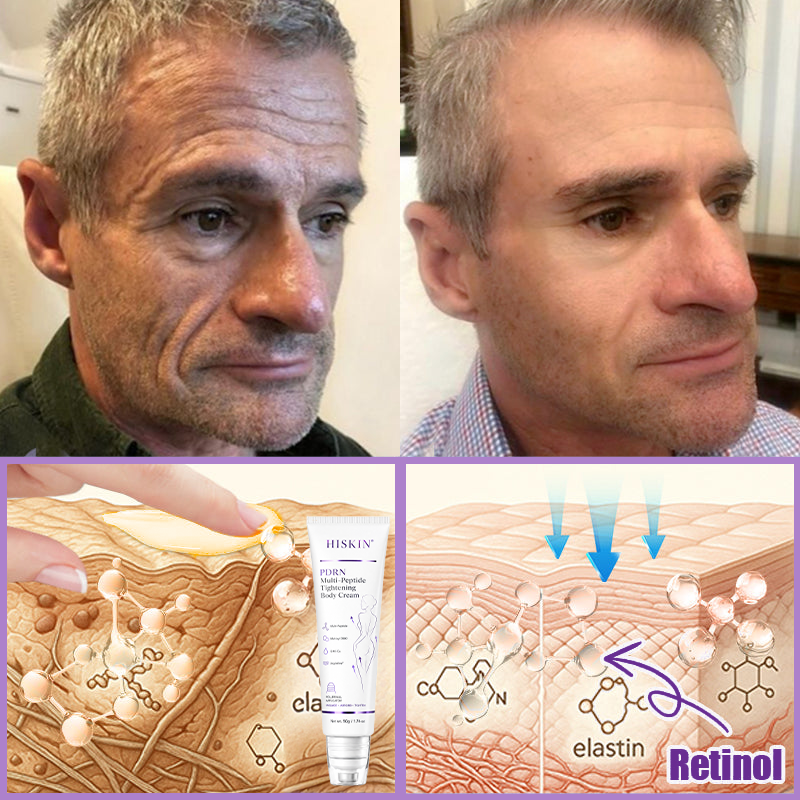❤FDA Official: Celsiora® PDRN Multi-Peptide Massaging Body Roller Cream- Anti-aging, Hydrating, Skin Firming & Lifting, Skin Repair, Even Tone, Acne and Dark Spot Treatment, Wart and Mole Removal, and Psoriasis Relief.