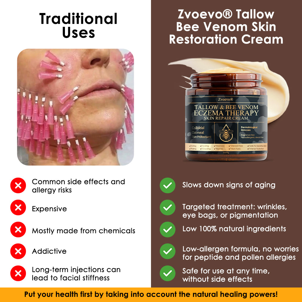 𝐅𝐃𝐀 𝐎𝐟𝐟𝐢𝐜𝐢𝐚𝐥: 𝐙𝐯𝐨𝐞𝐯𝐨® 𝐓𝐚𝐥𝐥𝐨𝐰 𝐁𝐞𝐞 𝐕𝐞𝐧𝐨𝐦 𝐒𝐤𝐢𝐧 𝐑𝐞𝐬𝐭𝐨𝐫𝐚𝐭𝐢𝐨𝐧 𝐂𝐫𝐞𝐚𝐦 - 𝐀𝐧𝐭𝐢-𝐚𝐠𝐢𝐧𝐠, 𝐇𝐲𝐝𝐫𝐚𝐭𝐢𝐧𝐠, 𝐒𝐤𝐢𝐧 𝐅𝐢𝐫𝐦𝐢𝐧𝐠 & 𝐋𝐢𝐟𝐭𝐢𝐧𝐠, 𝐒𝐤𝐢𝐧 𝐑𝐞𝐩𝐚𝐢𝐫, 𝐄𝐯𝐞𝐧 𝐓𝐨𝐧𝐞, 𝐀𝐜𝐧𝐞 𝐚𝐧𝐝 𝐃𝐚𝐫𝐤 𝐒𝐩𝐨𝐭 𝐓𝐫𝐞𝐚𝐭𝐦𝐞𝐧𝐭, 𝐖𝐚𝐫𝐭 𝐚𝐧𝐝 𝐌𝐨𝐥𝐞 𝐑𝐞𝐦𝐨𝐯𝐚𝐥, 𝐚𝐧𝐝 𝐏𝐬𝐨𝐫𝐢𝐚𝐬𝐢𝐬 𝐑𝐞𝐥𝐢𝐞𝐟.