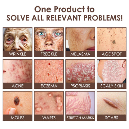 𝐅𝐃𝐀 𝐎𝐟𝐟𝐢𝐜𝐢𝐚𝐥: 𝐙𝐯𝐨𝐞𝐯𝐨® 𝐓𝐚𝐥𝐥𝐨𝐰 𝐁𝐞𝐞 𝐕𝐞𝐧𝐨𝐦 𝐒𝐤𝐢𝐧 𝐑𝐞𝐬𝐭𝐨𝐫𝐚𝐭𝐢𝐨𝐧 𝐂𝐫𝐞𝐚𝐦 - 𝐀𝐧𝐭𝐢-𝐚𝐠𝐢𝐧𝐠, 𝐇𝐲𝐝𝐫𝐚𝐭𝐢𝐧𝐠, 𝐒𝐤𝐢𝐧 𝐅𝐢𝐫𝐦𝐢𝐧𝐠 & 𝐋𝐢𝐟𝐭𝐢𝐧𝐠, 𝐒𝐤𝐢𝐧 𝐑𝐞𝐩𝐚𝐢𝐫, 𝐄𝐯𝐞𝐧 𝐓𝐨𝐧𝐞, 𝐀𝐜𝐧𝐞 𝐚𝐧𝐝 𝐃𝐚𝐫𝐤 𝐒𝐩𝐨𝐭 𝐓𝐫𝐞𝐚𝐭𝐦𝐞𝐧𝐭, 𝐖𝐚𝐫𝐭 𝐚𝐧𝐝 𝐌𝐨𝐥𝐞 𝐑𝐞𝐦𝐨𝐯𝐚𝐥, 𝐚𝐧𝐝 𝐏𝐬𝐨𝐫𝐢𝐚𝐬𝐢𝐬 𝐑𝐞𝐥𝐢𝐞𝐟.