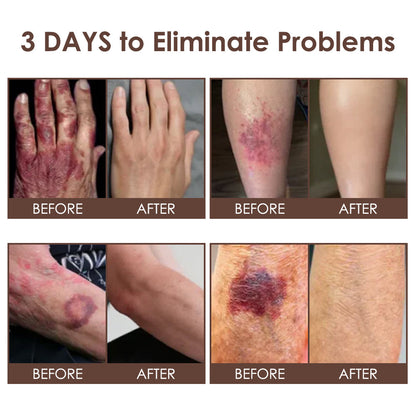 𝐅𝐃𝐀 𝐎𝐟𝐟𝐢𝐜𝐢𝐚𝐥: 𝐙𝐯𝐨𝐞𝐯𝐨® 𝐓𝐚𝐥𝐥𝐨𝐰 𝐁𝐞𝐞 𝐕𝐞𝐧𝐨𝐦 𝐒𝐤𝐢𝐧 𝐑𝐞𝐬𝐭𝐨𝐫𝐚𝐭𝐢𝐨𝐧 𝐂𝐫𝐞𝐚𝐦 - 𝐀𝐧𝐭𝐢-𝐚𝐠𝐢𝐧𝐠, 𝐇𝐲𝐝𝐫𝐚𝐭𝐢𝐧𝐠, 𝐒𝐤𝐢𝐧 𝐅𝐢𝐫𝐦𝐢𝐧𝐠 & 𝐋𝐢𝐟𝐭𝐢𝐧𝐠, 𝐒𝐤𝐢𝐧 𝐑𝐞𝐩𝐚𝐢𝐫, 𝐄𝐯𝐞𝐧 𝐓𝐨𝐧𝐞, 𝐀𝐜𝐧𝐞 𝐚𝐧𝐝 𝐃𝐚𝐫𝐤 𝐒𝐩𝐨𝐭 𝐓𝐫𝐞𝐚𝐭𝐦𝐞𝐧𝐭, 𝐖𝐚𝐫𝐭 𝐚𝐧𝐝 𝐌𝐨𝐥𝐞 𝐑𝐞𝐦𝐨𝐯𝐚𝐥, 𝐚𝐧𝐝 𝐏𝐬𝐨𝐫𝐢𝐚𝐬𝐢𝐬 𝐑𝐞𝐥𝐢𝐞𝐟.