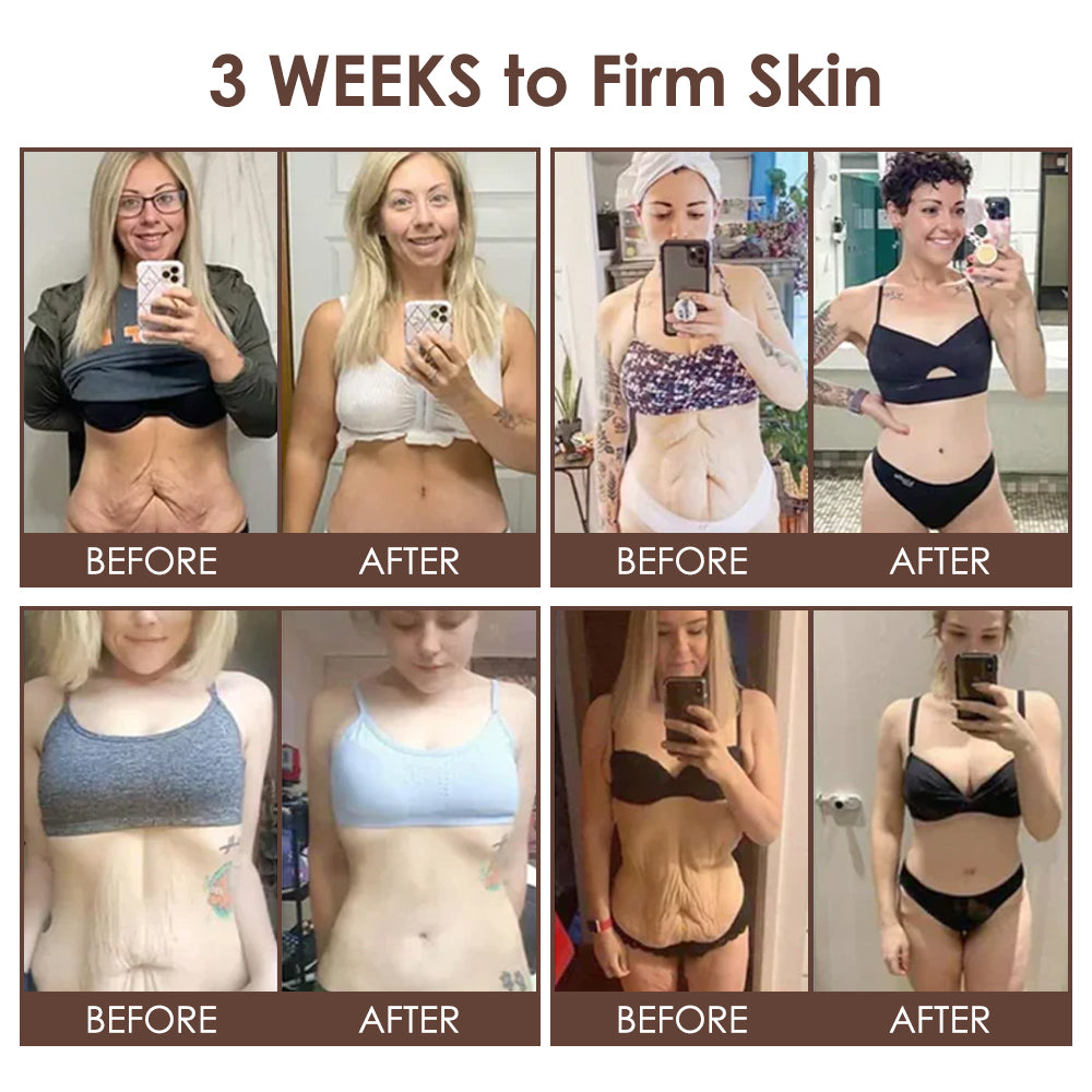 𝐅𝐃𝐀 𝐎𝐟𝐟𝐢𝐜𝐢𝐚𝐥: 𝐙𝐯𝐨𝐞𝐯𝐨® 𝐓𝐚𝐥𝐥𝐨𝐰 𝐁𝐞𝐞 𝐕𝐞𝐧𝐨𝐦 𝐒𝐤𝐢𝐧 𝐑𝐞𝐬𝐭𝐨𝐫𝐚𝐭𝐢𝐨𝐧 𝐂𝐫𝐞𝐚𝐦 - 𝐀𝐧𝐭𝐢-𝐚𝐠𝐢𝐧𝐠, 𝐇𝐲𝐝𝐫𝐚𝐭𝐢𝐧𝐠, 𝐒𝐤𝐢𝐧 𝐅𝐢𝐫𝐦𝐢𝐧𝐠 & 𝐋𝐢𝐟𝐭𝐢𝐧𝐠, 𝐒𝐤𝐢𝐧 𝐑𝐞𝐩𝐚𝐢𝐫, 𝐄𝐯𝐞𝐧 𝐓𝐨𝐧𝐞, 𝐀𝐜𝐧𝐞 𝐚𝐧𝐝 𝐃𝐚𝐫𝐤 𝐒𝐩𝐨𝐭 𝐓𝐫𝐞𝐚𝐭𝐦𝐞𝐧𝐭, 𝐖𝐚𝐫𝐭 𝐚𝐧𝐝 𝐌𝐨𝐥𝐞 𝐑𝐞𝐦𝐨𝐯𝐚𝐥, 𝐚𝐧𝐝 𝐏𝐬𝐨𝐫𝐢𝐚𝐬𝐢𝐬 𝐑𝐞𝐥𝐢𝐞𝐟.