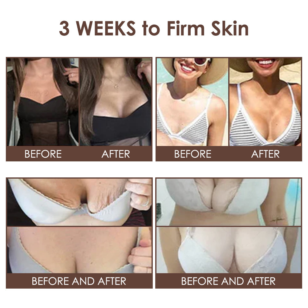𝐅𝐃𝐀 𝐎𝐟𝐟𝐢𝐜𝐢𝐚𝐥: 𝐙𝐯𝐨𝐞𝐯𝐨® 𝐓𝐚𝐥𝐥𝐨𝐰 𝐁𝐞𝐞 𝐕𝐞𝐧𝐨𝐦 𝐒𝐤𝐢𝐧 𝐑𝐞𝐬𝐭𝐨𝐫𝐚𝐭𝐢𝐨𝐧 𝐂𝐫𝐞𝐚𝐦 - 𝐀𝐧𝐭𝐢-𝐚𝐠𝐢𝐧𝐠, 𝐇𝐲𝐝𝐫𝐚𝐭𝐢𝐧𝐠, 𝐒𝐤𝐢𝐧 𝐅𝐢𝐫𝐦𝐢𝐧𝐠 & 𝐋𝐢𝐟𝐭𝐢𝐧𝐠, 𝐒𝐤𝐢𝐧 𝐑𝐞𝐩𝐚𝐢𝐫, 𝐄𝐯𝐞𝐧 𝐓𝐨𝐧𝐞, 𝐀𝐜𝐧𝐞 𝐚𝐧𝐝 𝐃𝐚𝐫𝐤 𝐒𝐩𝐨𝐭 𝐓𝐫𝐞𝐚𝐭𝐦𝐞𝐧𝐭, 𝐖𝐚𝐫𝐭 𝐚𝐧𝐝 𝐌𝐨𝐥𝐞 𝐑𝐞𝐦𝐨𝐯𝐚𝐥, 𝐚𝐧𝐝 𝐏𝐬𝐨𝐫𝐢𝐚𝐬𝐢𝐬 𝐑𝐞𝐥𝐢𝐞𝐟.