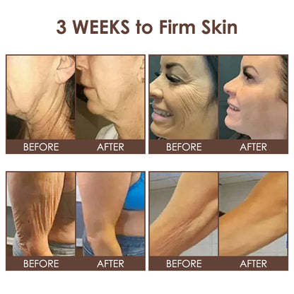 𝐅𝐃𝐀 𝐎𝐟𝐟𝐢𝐜𝐢𝐚𝐥: 𝐙𝐯𝐨𝐞𝐯𝐨® 𝐓𝐚𝐥𝐥𝐨𝐰 𝐁𝐞𝐞 𝐕𝐞𝐧𝐨𝐦 𝐒𝐤𝐢𝐧 𝐑𝐞𝐬𝐭𝐨𝐫𝐚𝐭𝐢𝐨𝐧 𝐂𝐫𝐞𝐚𝐦 - 𝐀𝐧𝐭𝐢-𝐚𝐠𝐢𝐧𝐠, 𝐇𝐲𝐝𝐫𝐚𝐭𝐢𝐧𝐠, 𝐒𝐤𝐢𝐧 𝐅𝐢𝐫𝐦𝐢𝐧𝐠 & 𝐋𝐢𝐟𝐭𝐢𝐧𝐠, 𝐒𝐤𝐢𝐧 𝐑𝐞𝐩𝐚𝐢𝐫, 𝐄𝐯𝐞𝐧 𝐓𝐨𝐧𝐞, 𝐀𝐜𝐧𝐞 𝐚𝐧𝐝 𝐃𝐚𝐫𝐤 𝐒𝐩𝐨𝐭 𝐓𝐫𝐞𝐚𝐭𝐦𝐞𝐧𝐭, 𝐖𝐚𝐫𝐭 𝐚𝐧𝐝 𝐌𝐨𝐥𝐞 𝐑𝐞𝐦𝐨𝐯𝐚𝐥, 𝐚𝐧𝐝 𝐏𝐬𝐨𝐫𝐢𝐚𝐬𝐢𝐬 𝐑𝐞𝐥𝐢𝐞𝐟.