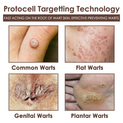 𝐅𝐃𝐀 𝐎𝐟𝐟𝐢𝐜𝐢𝐚𝐥: 𝐙𝐯𝐨𝐞𝐯𝐨® 𝐓𝐚𝐥𝐥𝐨𝐰 𝐁𝐞𝐞 𝐕𝐞𝐧𝐨𝐦 𝐒𝐤𝐢𝐧 𝐑𝐞𝐬𝐭𝐨𝐫𝐚𝐭𝐢𝐨𝐧 𝐂𝐫𝐞𝐚𝐦 - 𝐀𝐧𝐭𝐢-𝐚𝐠𝐢𝐧𝐠, 𝐇𝐲𝐝𝐫𝐚𝐭𝐢𝐧𝐠, 𝐒𝐤𝐢𝐧 𝐅𝐢𝐫𝐦𝐢𝐧𝐠 & 𝐋𝐢𝐟𝐭𝐢𝐧𝐠, 𝐒𝐤𝐢𝐧 𝐑𝐞𝐩𝐚𝐢𝐫, 𝐄𝐯𝐞𝐧 𝐓𝐨𝐧𝐞, 𝐀𝐜𝐧𝐞 𝐚𝐧𝐝 𝐃𝐚𝐫𝐤 𝐒𝐩𝐨𝐭 𝐓𝐫𝐞𝐚𝐭𝐦𝐞𝐧𝐭, 𝐖𝐚𝐫𝐭 𝐚𝐧𝐝 𝐌𝐨𝐥𝐞 𝐑𝐞𝐦𝐨𝐯𝐚𝐥, 𝐚𝐧𝐝 𝐏𝐬𝐨𝐫𝐢𝐚𝐬𝐢𝐬 𝐑𝐞𝐥𝐢𝐞𝐟.