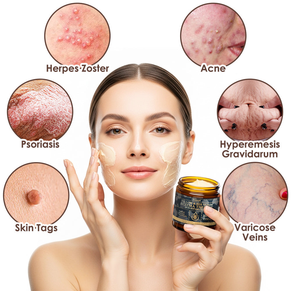 𝐅𝐃𝐀 𝐎𝐟𝐟𝐢𝐜𝐢𝐚𝐥: 𝐙𝐯𝐨𝐞𝐯𝐨® 𝐓𝐚𝐥𝐥𝐨𝐰 𝐁𝐞𝐞 𝐕𝐞𝐧𝐨𝐦 𝐒𝐤𝐢𝐧 𝐑𝐞𝐬𝐭𝐨𝐫𝐚𝐭𝐢𝐨𝐧 𝐂𝐫𝐞𝐚𝐦 - 𝐀𝐧𝐭𝐢-𝐚𝐠𝐢𝐧𝐠, 𝐇𝐲𝐝𝐫𝐚𝐭𝐢𝐧𝐠, 𝐒𝐤𝐢𝐧 𝐅𝐢𝐫𝐦𝐢𝐧𝐠 & 𝐋𝐢𝐟𝐭𝐢𝐧𝐠, 𝐒𝐤𝐢𝐧 𝐑𝐞𝐩𝐚𝐢𝐫, 𝐄𝐯𝐞𝐧 𝐓𝐨𝐧𝐞, 𝐀𝐜𝐧𝐞 𝐚𝐧𝐝 𝐃𝐚𝐫𝐤 𝐒𝐩𝐨𝐭 𝐓𝐫𝐞𝐚𝐭𝐦𝐞𝐧𝐭, 𝐖𝐚𝐫𝐭 𝐚𝐧𝐝 𝐌𝐨𝐥𝐞 𝐑𝐞𝐦𝐨𝐯𝐚𝐥, 𝐚𝐧𝐝 𝐏𝐬𝐨𝐫𝐢𝐚𝐬𝐢𝐬 𝐑𝐞𝐥𝐢𝐞𝐟.