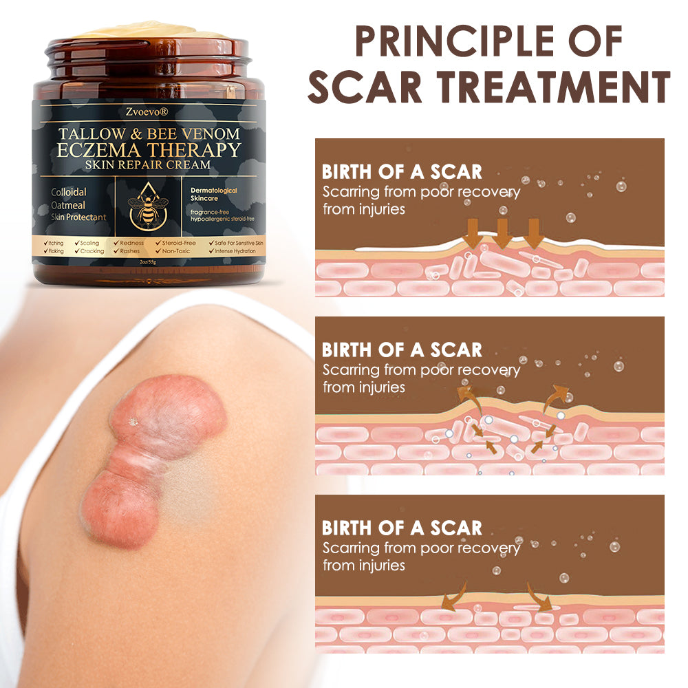 𝐅𝐃𝐀 𝐎𝐟𝐟𝐢𝐜𝐢𝐚𝐥: 𝐙𝐯𝐨𝐞𝐯𝐨® 𝐓𝐚𝐥𝐥𝐨𝐰 𝐁𝐞𝐞 𝐕𝐞𝐧𝐨𝐦 𝐒𝐤𝐢𝐧 𝐑𝐞𝐬𝐭𝐨𝐫𝐚𝐭𝐢𝐨𝐧 𝐂𝐫𝐞𝐚𝐦 - 𝐀𝐧𝐭𝐢-𝐚𝐠𝐢𝐧𝐠, 𝐇𝐲𝐝𝐫𝐚𝐭𝐢𝐧𝐠, 𝐒𝐤𝐢𝐧 𝐅𝐢𝐫𝐦𝐢𝐧𝐠 & 𝐋𝐢𝐟𝐭𝐢𝐧𝐠, 𝐒𝐤𝐢𝐧 𝐑𝐞𝐩𝐚𝐢𝐫, 𝐄𝐯𝐞𝐧 𝐓𝐨𝐧𝐞, 𝐀𝐜𝐧𝐞 𝐚𝐧𝐝 𝐃𝐚𝐫𝐤 𝐒𝐩𝐨𝐭 𝐓𝐫𝐞𝐚𝐭𝐦𝐞𝐧𝐭, 𝐖𝐚𝐫𝐭 𝐚𝐧𝐝 𝐌𝐨𝐥𝐞 𝐑𝐞𝐦𝐨𝐯𝐚𝐥, 𝐚𝐧𝐝 𝐏𝐬𝐨𝐫𝐢𝐚𝐬𝐢𝐬 𝐑𝐞𝐥𝐢𝐞𝐟.