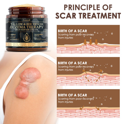 𝐅𝐃𝐀 𝐎𝐟𝐟𝐢𝐜𝐢𝐚𝐥: 𝐙𝐯𝐨𝐞𝐯𝐨® 𝐓𝐚𝐥𝐥𝐨𝐰 𝐁𝐞𝐞 𝐕𝐞𝐧𝐨𝐦 𝐒𝐤𝐢𝐧 𝐑𝐞𝐬𝐭𝐨𝐫𝐚𝐭𝐢𝐨𝐧 𝐂𝐫𝐞𝐚𝐦 - 𝐀𝐧𝐭𝐢-𝐚𝐠𝐢𝐧𝐠, 𝐇𝐲𝐝𝐫𝐚𝐭𝐢𝐧𝐠, 𝐒𝐤𝐢𝐧 𝐅𝐢𝐫𝐦𝐢𝐧𝐠 & 𝐋𝐢𝐟𝐭𝐢𝐧𝐠, 𝐒𝐤𝐢𝐧 𝐑𝐞𝐩𝐚𝐢𝐫, 𝐄𝐯𝐞𝐧 𝐓𝐨𝐧𝐞, 𝐀𝐜𝐧𝐞 𝐚𝐧𝐝 𝐃𝐚𝐫𝐤 𝐒𝐩𝐨𝐭 𝐓𝐫𝐞𝐚𝐭𝐦𝐞𝐧𝐭, 𝐖𝐚𝐫𝐭 𝐚𝐧𝐝 𝐌𝐨𝐥𝐞 𝐑𝐞𝐦𝐨𝐯𝐚𝐥, 𝐚𝐧𝐝 𝐏𝐬𝐨𝐫𝐢𝐚𝐬𝐢𝐬 𝐑𝐞𝐥𝐢𝐞𝐟.